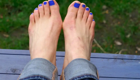 Say Goodbye to Bunion Pain: Choosing the Perfect Relief Products